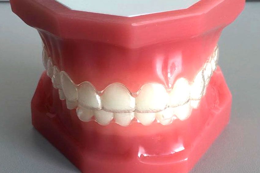 Especialistas en ortodoncia